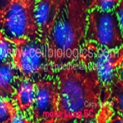 Diabetic Mouse Endothelial (24)